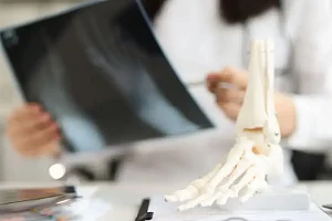 Złamania kości – kompleksowy przewodnik od leczenia do rehabilitacji